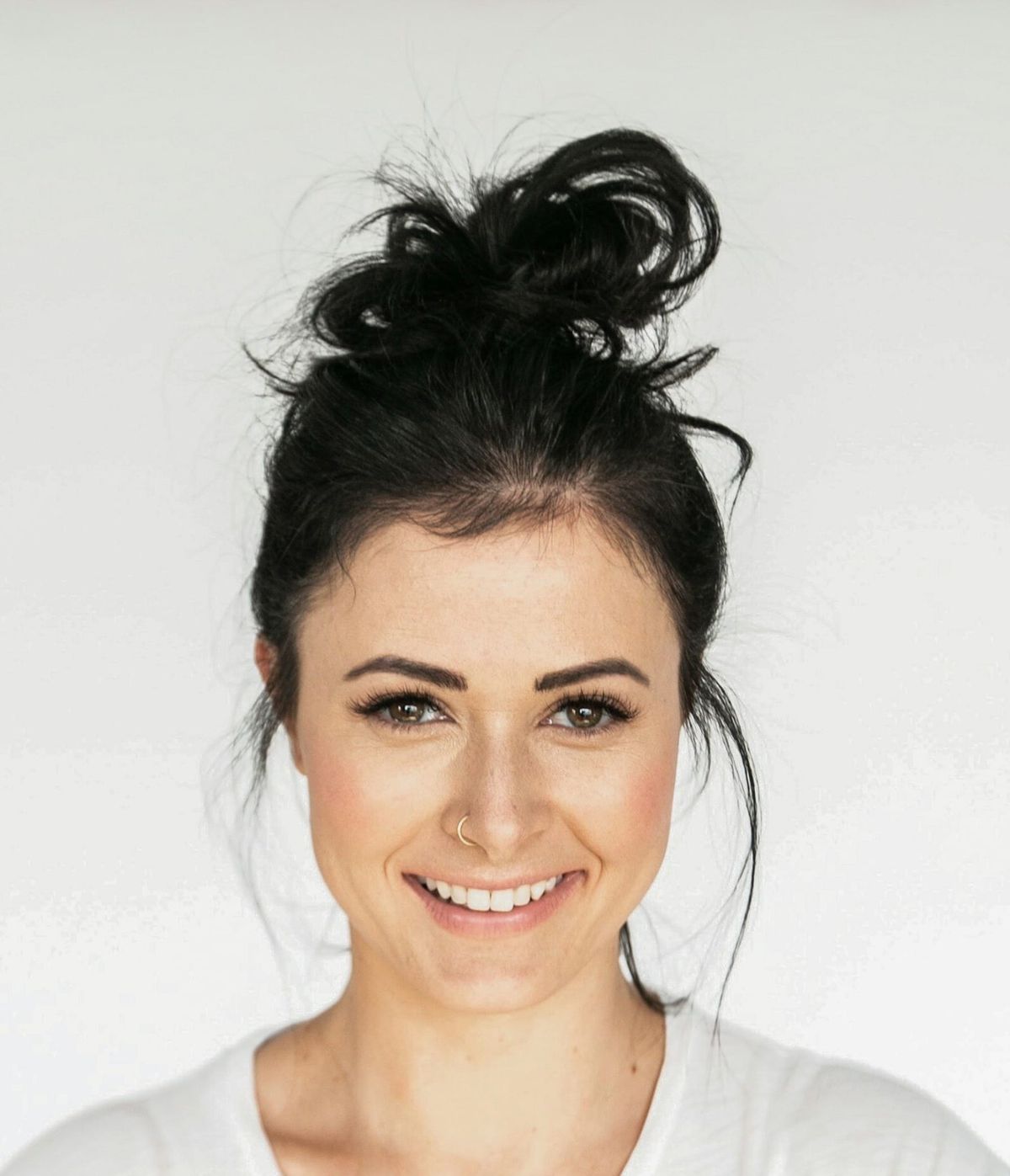 Facelift vs. Dermal Fillers - Which Gives the Best Rejuvenation?