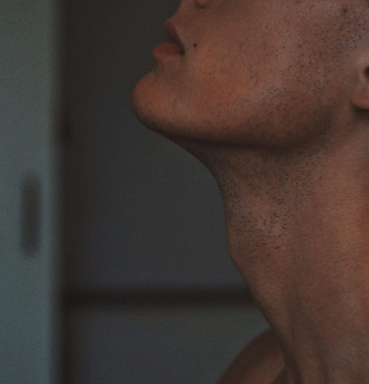 Neck Lift vs. Kybella: Which Works Best for Double Chin?