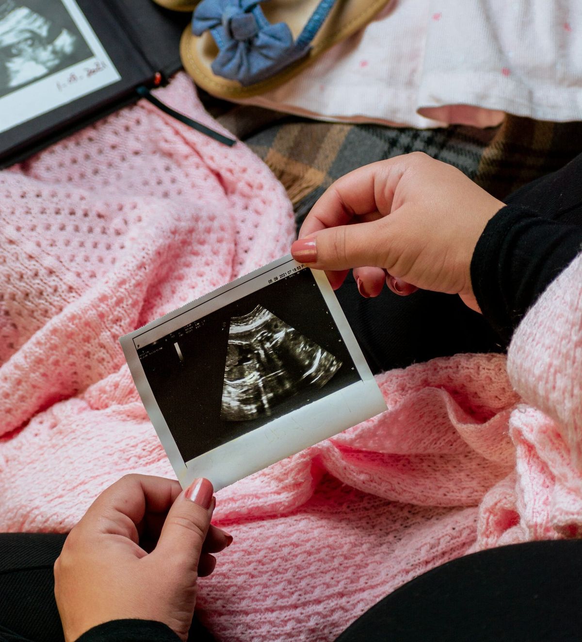 Can I Get a Mommy Makeover Before Having Kids?