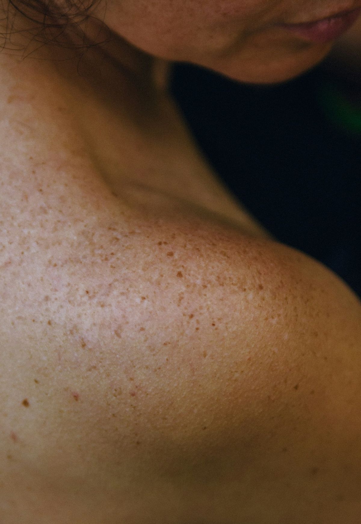 Skin Rejuvenation and Resurfacing Cost in Houston (2025 Guide)