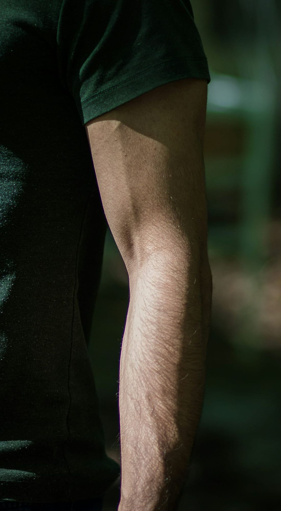 Am I a Good Candidate for Arm Lift?