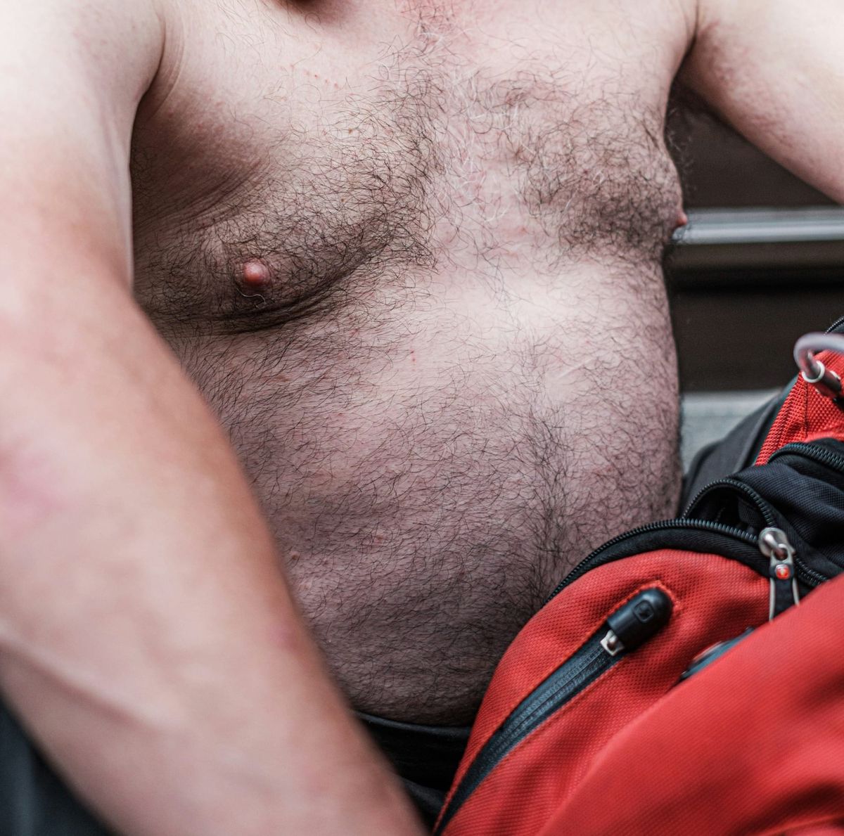 Male Liposuction vs. CoolSculpting — Which Delivers Sharper Definition?