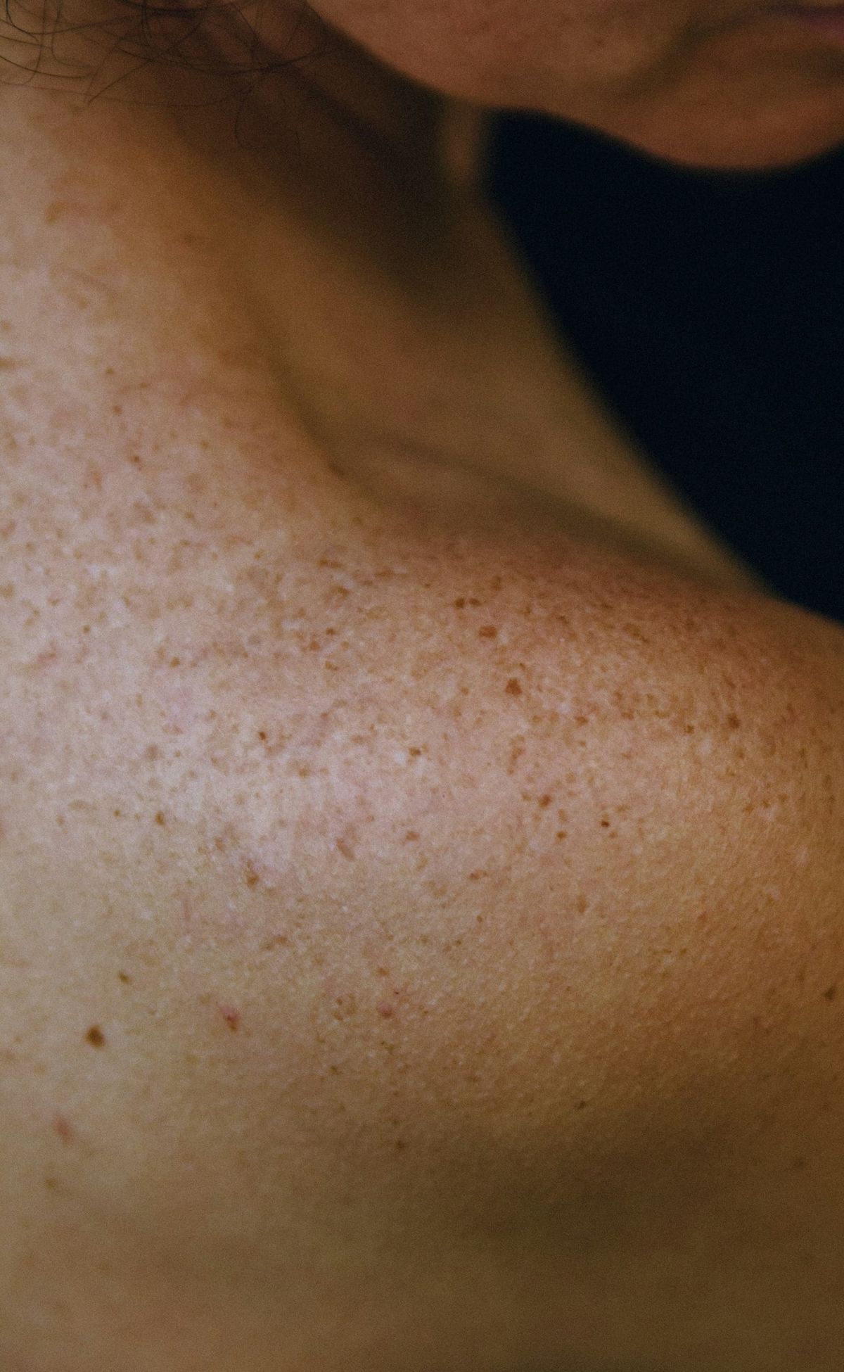 Best Skin Tightening Surgeons in Chicago (2025 Guide)