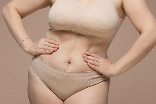 Am I a Good Candidate for a Tummy Tuck (Abdominoplasty)?