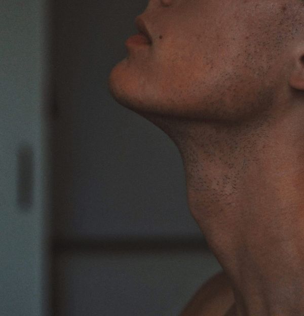 Neck Lift vs. Kybella: Which Works Best for Double Chin?