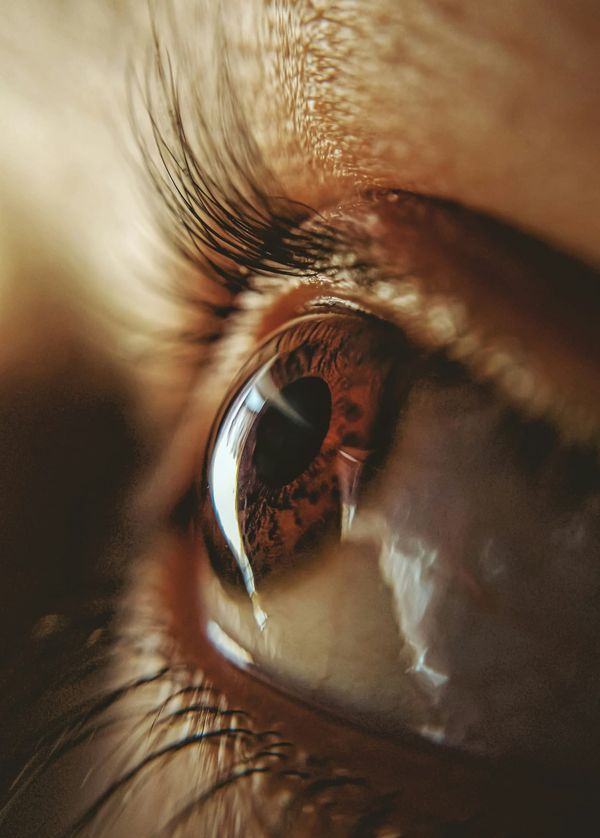 Eyelid Surgery vs. Brow Lift Which Do You Need?