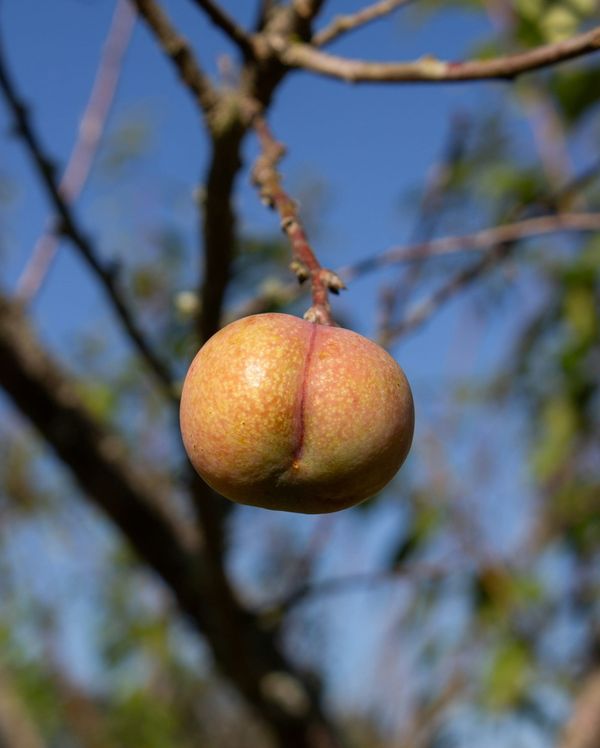 Best BBL Surgeons in Tampa (2025 Guide)