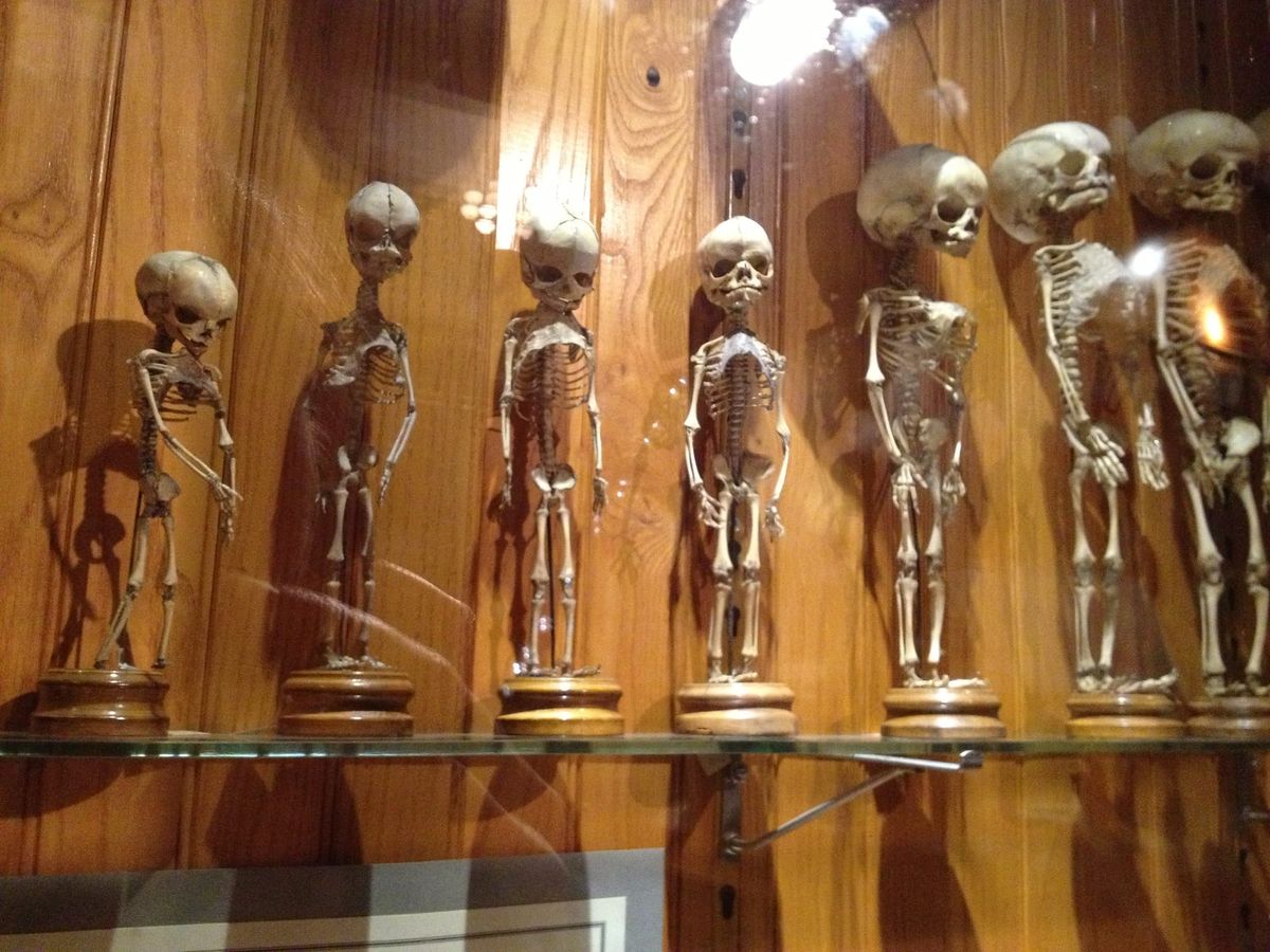 Interior of the Mütter Museum in Philadelphia, historic medical museum addressing human remains with new ethical policy.