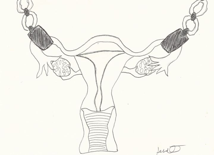 'Trivialized and Demonized,' Women's Resource Center Staffers on the State of Reproductive Rights