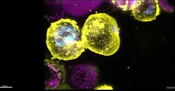 Cellular Senescence: Understanding an Antagonistic Hallmark of Aging