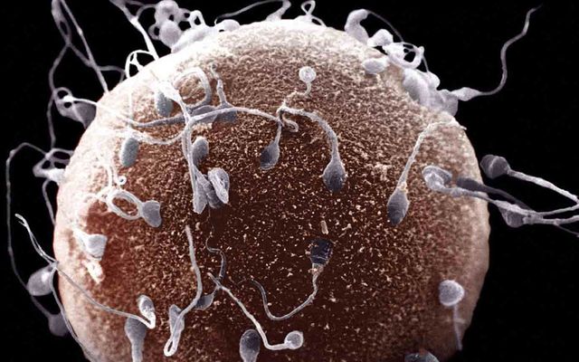 evolution's fight for the y chromosome