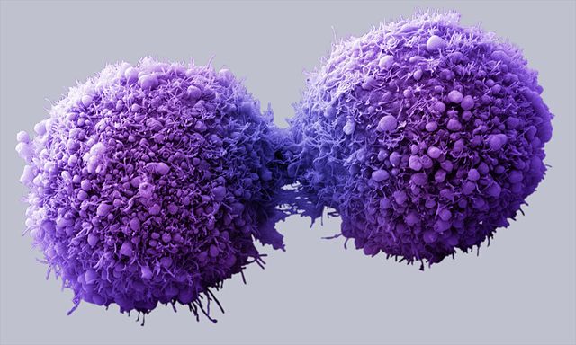 a new, smarter weapon against cancer cells?
