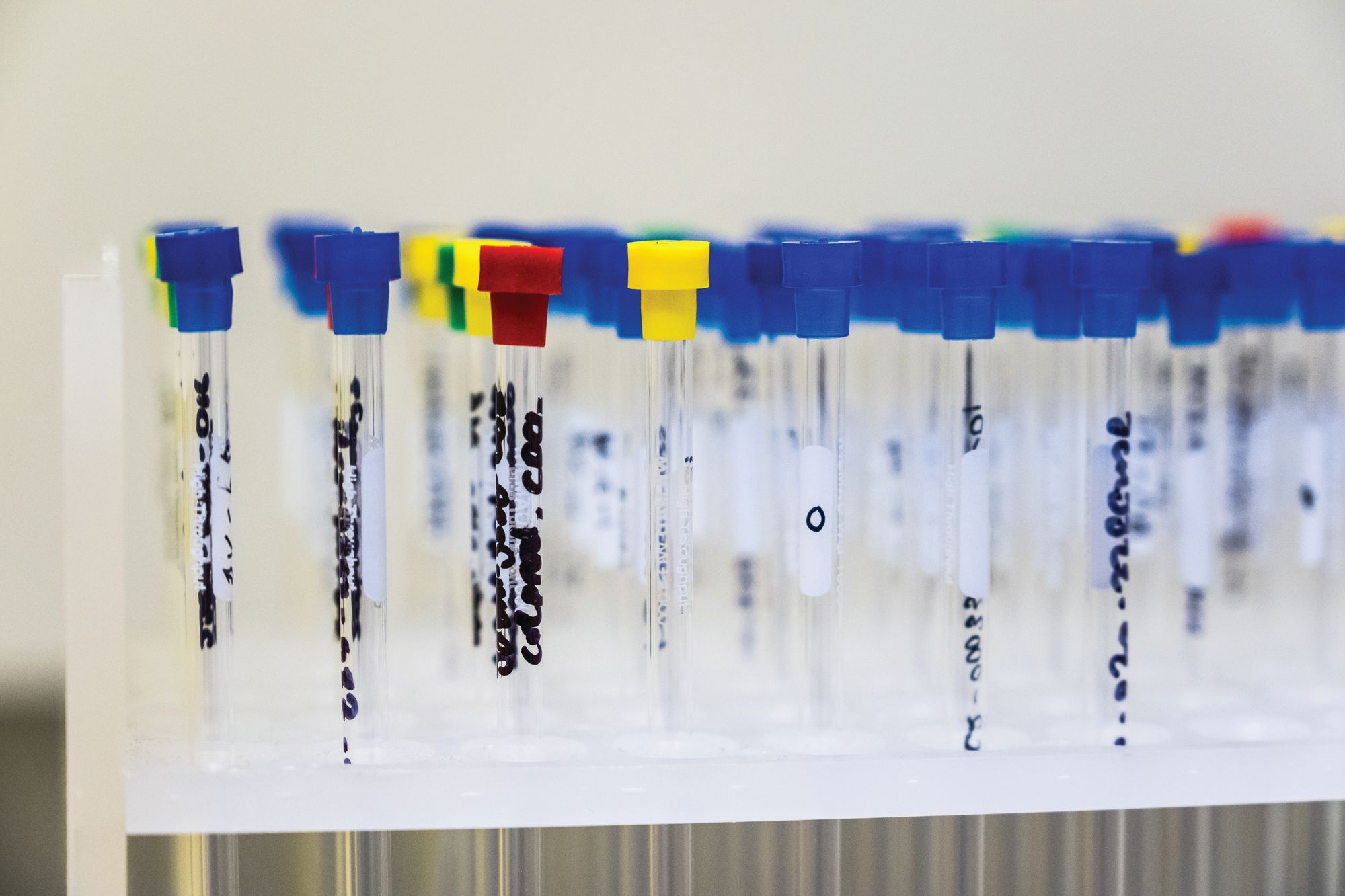 Eisai test tubes