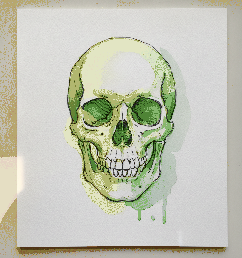 Skull With Soft Tissue Overlay Diagram, Anatomical Illustration example 3