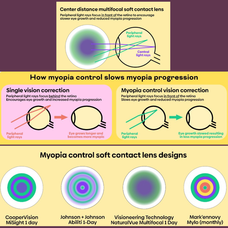 Collage of images from myKidsVision.org showing how the contacts work. Click the image to go to the source.
