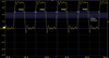 A Robust Method for Measuring Clock Jitter with Oscilloscopes