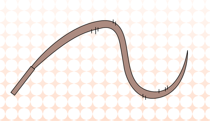 Whiplash 뜻과 예시 (편타 손상)