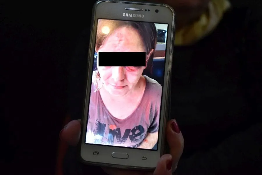 “Moju bolesnu kći brutalno su pretukli policajci”