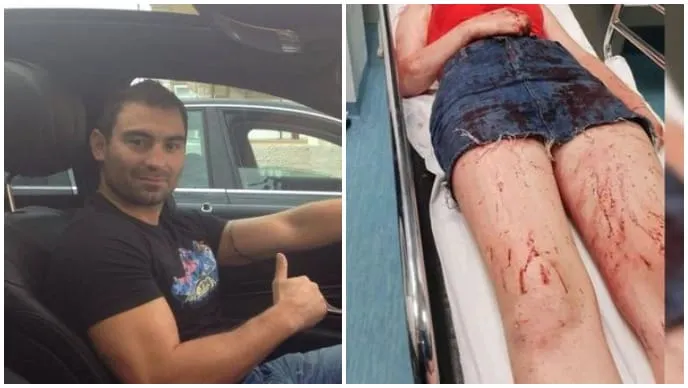 Vještak: “Daruvarac je bio uračunjiv dok je tukao djevojku. Znao je što radi”