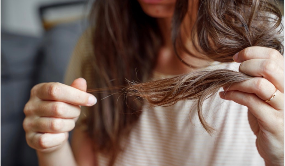 Why is Everybody Talking About Losing Their Hair?