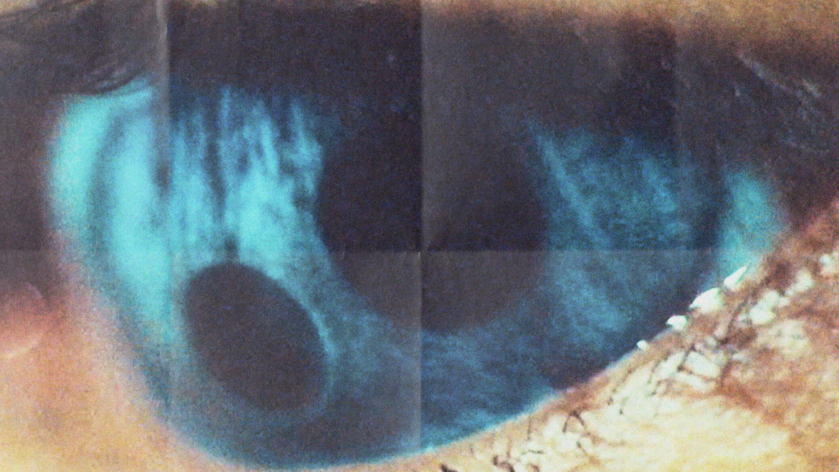 Psicosis inducida por inteligencia artificial