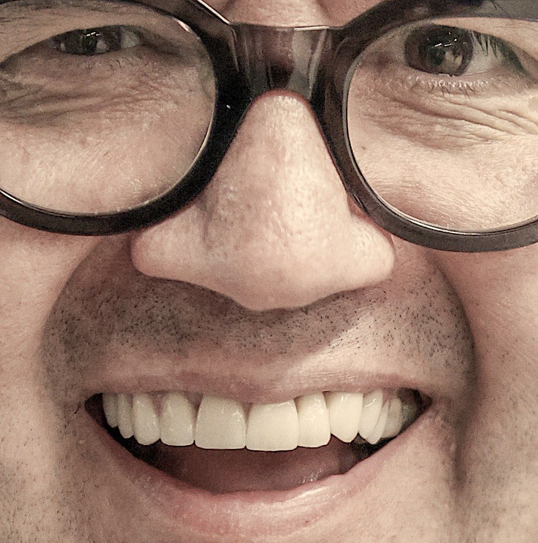 No. 43 - Le Principe de Denis