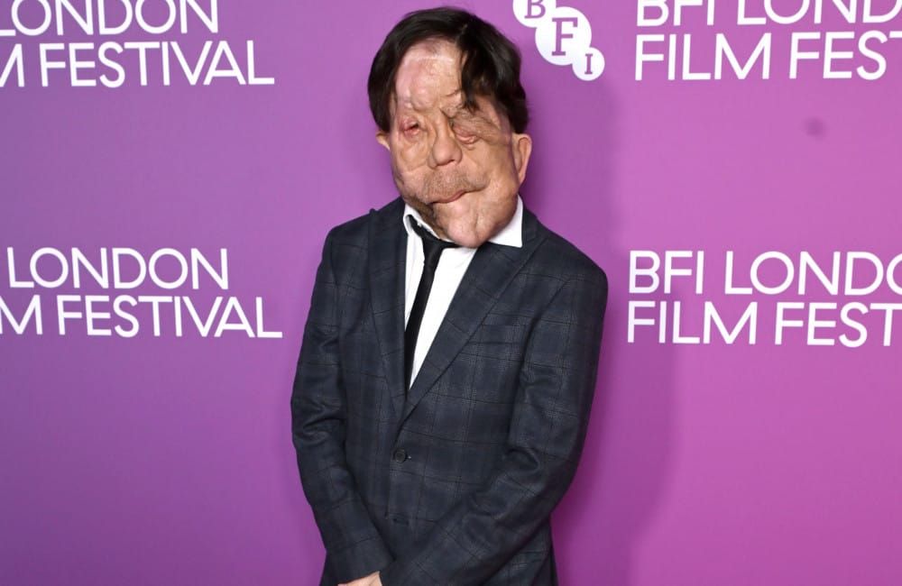Adam Pearson sieht Fortschritte für Schauspieler mit Behinderungen