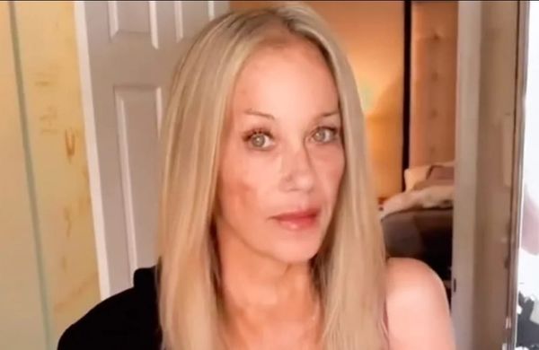 Christina Applegate zeigt sich erstmals seit Krankenhausaufenthalt wieder im Video
