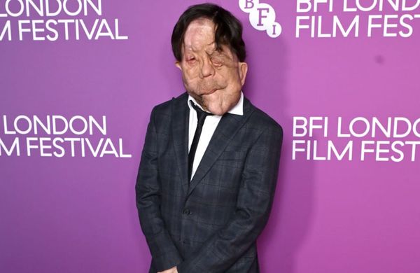 Adam Pearson sieht Fortschritte für Schauspieler mit Behinderungen
