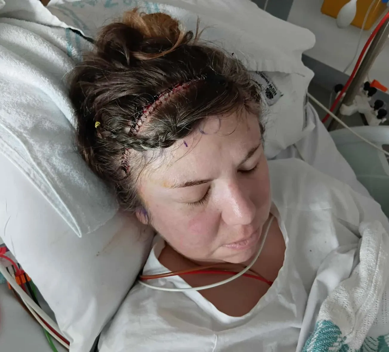 Cancer patients pushed into the 'working poor' as support falls short