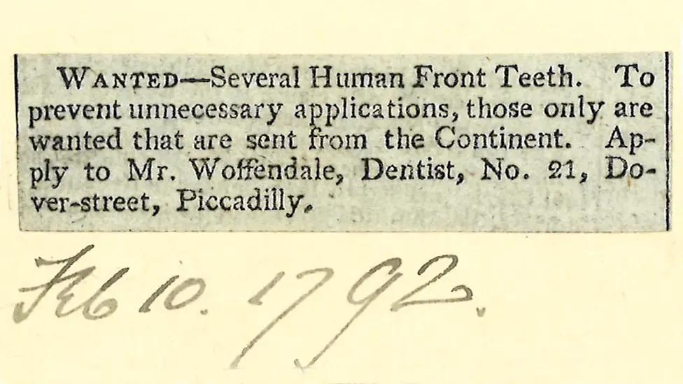 Did George Washington have wooden teeth? No. It was much weirder.