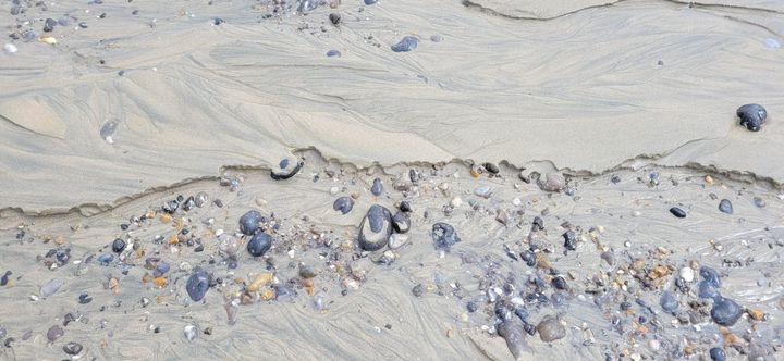 Quand les femmes infertiles ressemblent aux femmes enceintes