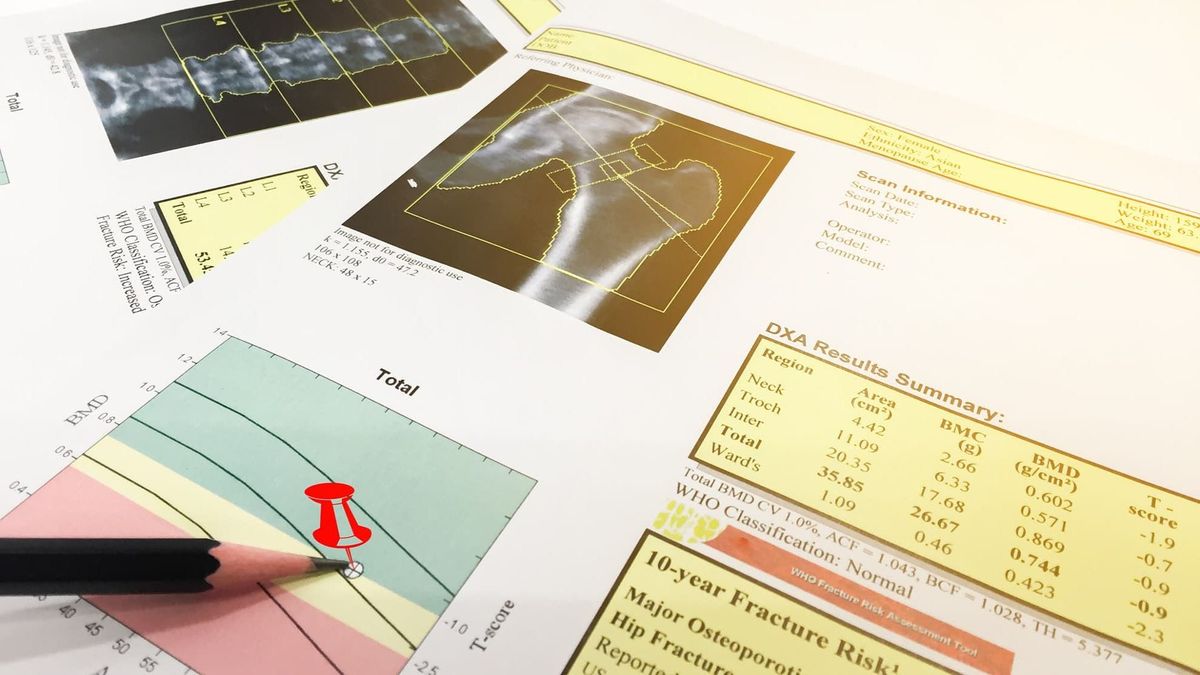 New machine algorithm could identify cardiovascular risk at the click of a button