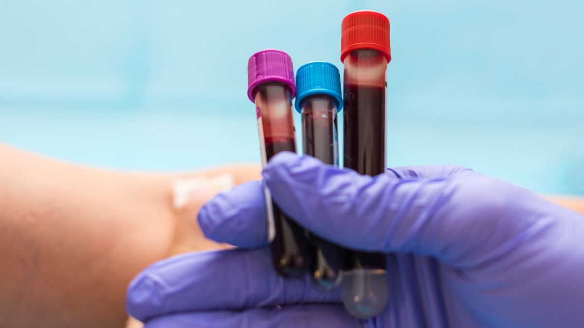 Your body's secret sugar code could predict disease years before it strikes