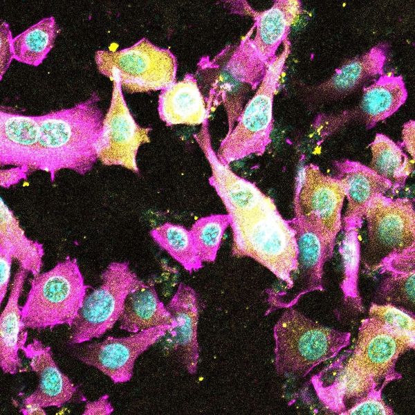 Scientists reveal new toxin that damages the gut