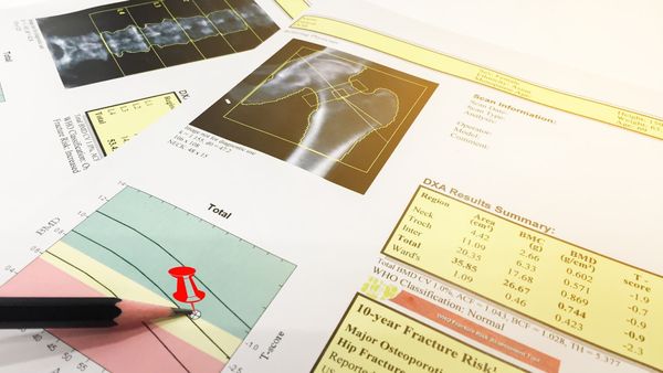 New machine algorithm could identify cardiovascular risk at the click of a button