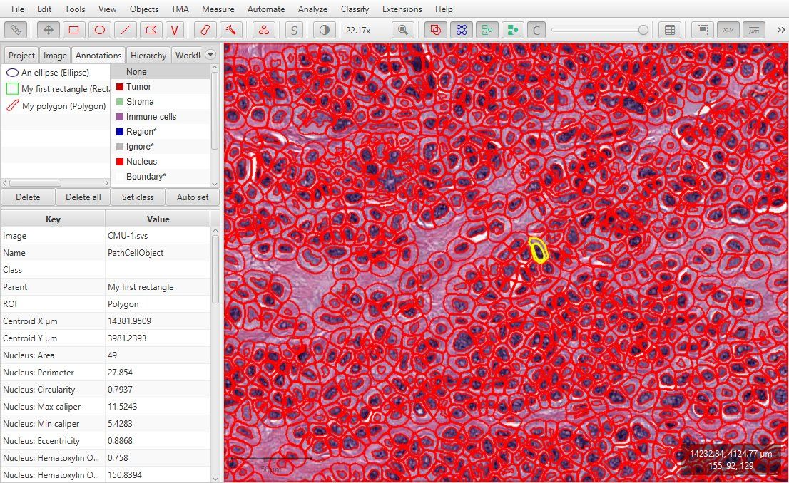 QuPath graphical user interface with cells outlined in red.