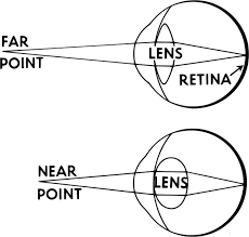 a diagram of accommodation of the eye