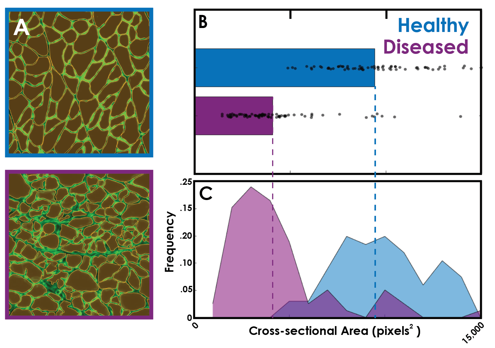 muscle stain with ROI overlay, a bar graph, and a frequency distribution