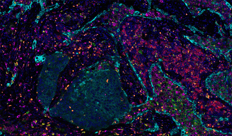 More data, more problems: Perspectives on challenges in large-scale, high-complexity bioimage analysis