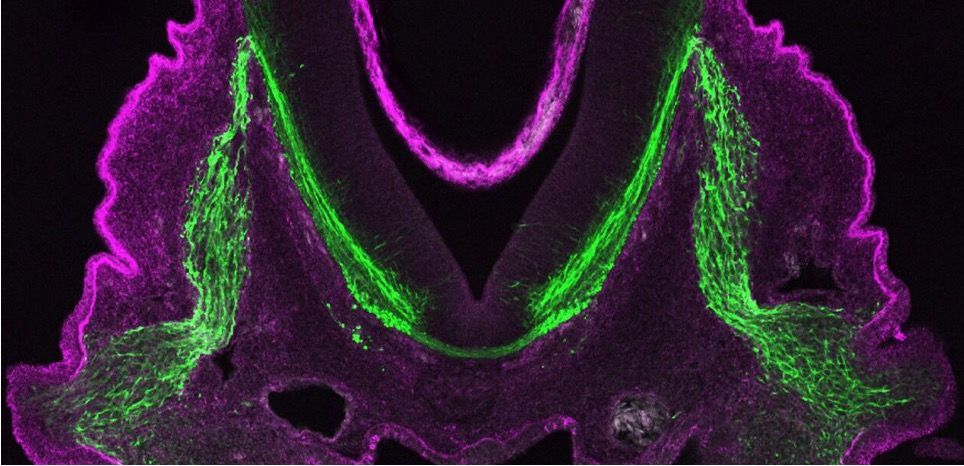 Flavors of microscopy in biomedical research
