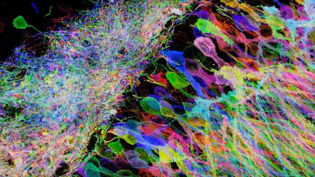 Cheating the Diffraction Limit with Expansion Microscopy