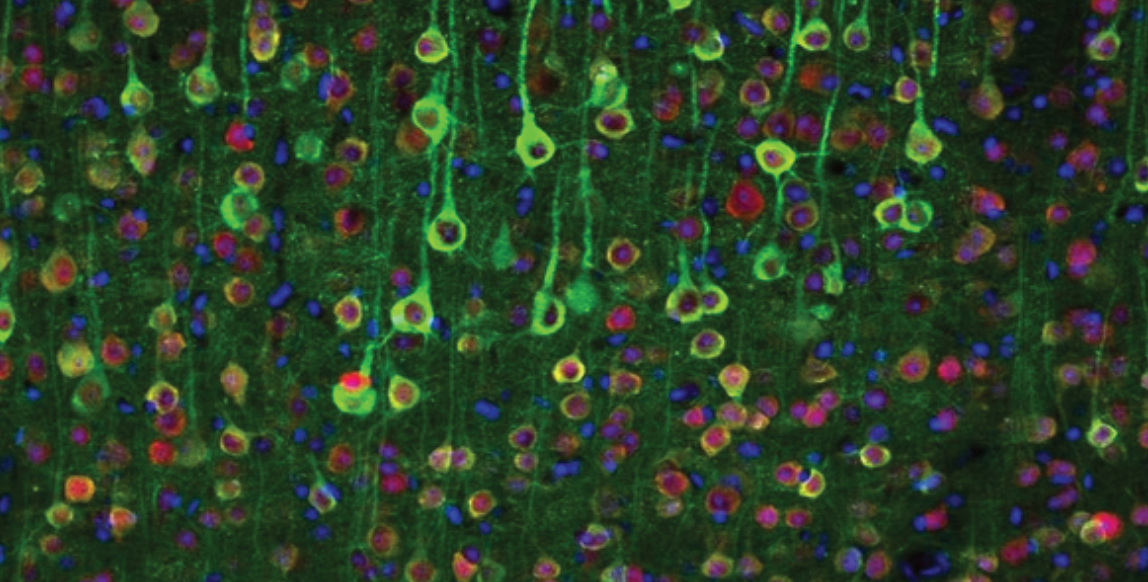 Playing the brain's music back to itself with holographic optogenetics