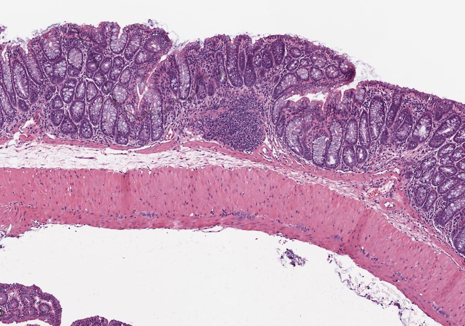 Semantic vs. Instance Segmentation: Applications for Biology