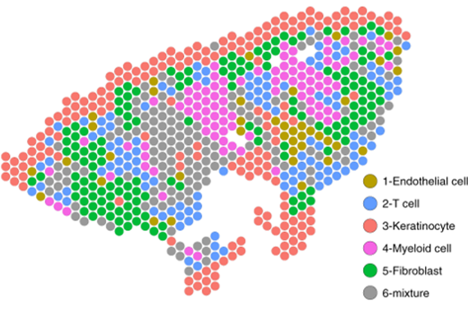 Integrating scRNAseq and spatial sequencing drives new findings on leprosy