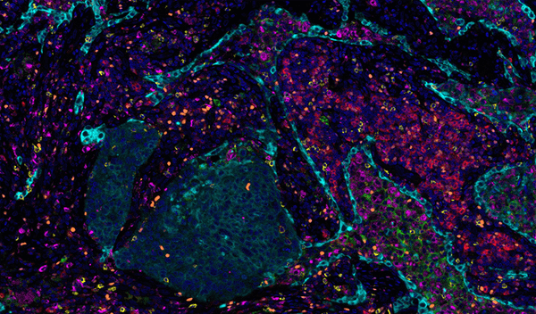 More data, more problems: Perspectives on challenges in large-scale, high-complexity bioimage analysis