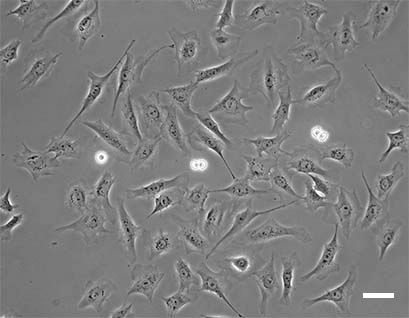 How to train your model: LIVECell for AI-assisted cell segmentation