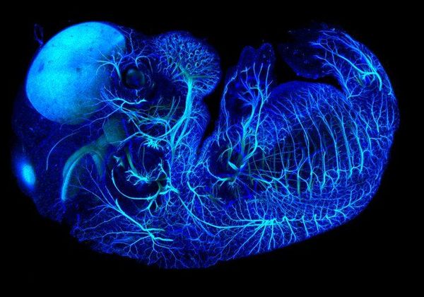 Seeing clearly yet?: An overview of tissue clearing