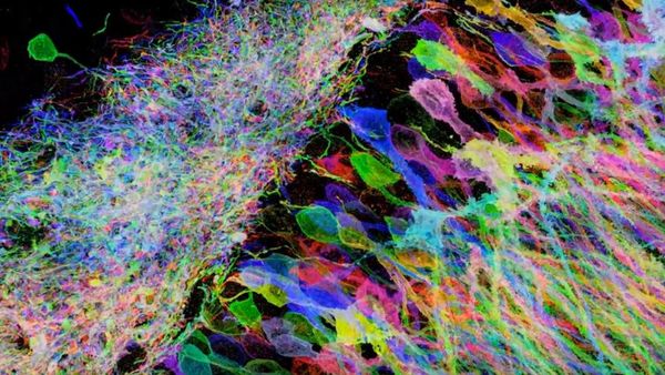 Cheating the Diffraction Limit with Expansion Microscopy