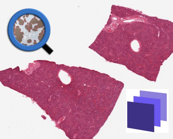 Integrating Bioimage Tools: A Case for Data Fusion with QuPath and Biodock